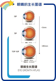 眼轴生长图谱